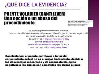 La odontología conservadora del presente,
llama la atención sobre las alternativas en esa dirección, por lo tanto la mejor opción
con menor afectación dental y de las estructuras
de soporte, es el implante oseointegrado,
luego la dentadura removible
convencional o con ataches y por último la
más controversial el puente cantilever
Conclusiones: el puente cantilever a la luz del
conocimiento actual no es el mejor tratamiento, debido a
las desventajas mecánicas y de respuesta biológica
negativas a las cuales son sometidas las piezas pilares
 