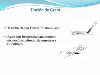 Tinción de Gram<br />Descubierta por Hans Christian Gram.<br />Usada con frecuencia para examen microscópico directo de mu...