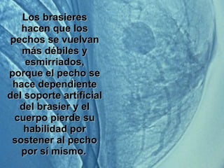 Los brasieres hacen que los pechos se vuelvan más débiles y esmirriados, porque el pecho se hace dependiente del soporte artificial del brasier y el cuerpo pierde su habilidad por sostener al pecho por sí mismo.   