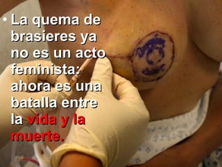 La quema de brasieres ya no es un acto feminista: ahora es una batalla entre la   vida y la muerte. 