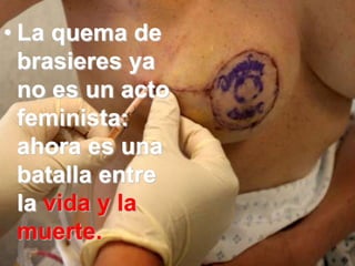 • La quema de
  brasieres ya
  no es un acto
  feminista:
  ahora es una
  batalla entre
  la vida y la
  muerte.
 