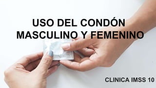 USO DEL CONDÓN
MASCULINO Y FEMENINO
CLINICA IMSS 10
 