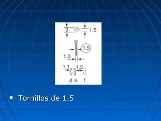 TToorrnniillllooss ddee 1..55 
 