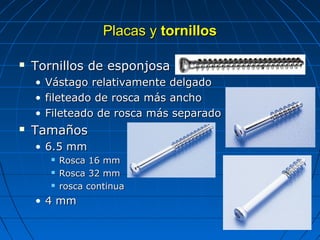 PPllaaccaass yy ttoorrnniillllooss 
 TToorrnniillllooss ddee eessppoonnjjoossaa 
• VVáássttaaggoo rreellaattiivvaammeennttee ddeellggaaddoo 
• ffiilleetteeaaddoo ddee rroossccaa mmááss aanncchhoo 
• FFiilleetteeaaddoo ddee rroossccaa mmááss sseeppaarraaddoo 
 TTaammaaññooss 
• 6..55 mmmm 
 RRoossccaa 16 mmmm 
 RRoossccaa 3322 mmmm 
 rroossccaa ccoonnttiinnuuaa 
• 44 mmmm 
 