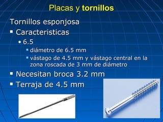 PPllaaccaass yy ttoorrnniillllooss 
TToorrnniillllooss eessppoonnjjoossaa 
 CCaarraacctteerriissttiiccaass 
• 66..55 
 ddiiáámmeettrroo ddee 66..55 mmmm 
 vváássttaaggoo ddee 44..55 mmmm yy vváássttaaggoo cceennttrraall eenn llaa 
zzoonnaa rroossccaaddaa ddee 33 mmmm ddee ddiiáámmeettrroo 
 NNeecceessiittaann bbrrooccaa 33..22 mmmm 
 TTeerrrraajjaa ddee 44..55 mmmm 
 
