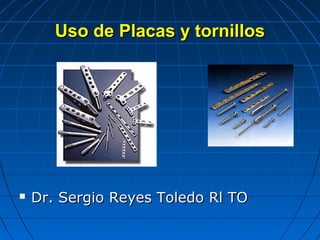 UUssoo ddee PPllaaccaass yy ttoorrnniillllooss 
 DDrr.. SSeerrggiioo RReeyyeess TToolleeddoo RRll TTOO 
 