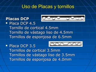 UUssoo ddee PPllaaccaass yy ttoorrnniillllooss 
PPllaaccaass DDCCPP 
 PPllaaccaa DDCCPP 44..55 
TToorrnniilllloo ddee ccoorrttiiccaall 44..55mmmm 
TToorrnniilllloo ddee vváássttaaggoo lliissoo ddee 44..55mmmm 
TToorrnniillllooss ddee eessppoonnjjoossaa ddee 66..55mmmm 
 PPllaaccaa DDCCPP 33..55 
TToorrnniillllooss ddee ccoorrttiiccaall 33..55mmmm 
TToorrnniillllooss ddee vváássttaaggoo lliissoo ddee 33..55mmmm 
TToorrnniillllooss ddee eessppoonnjjoossaa ddee 44..00mmmm 
 