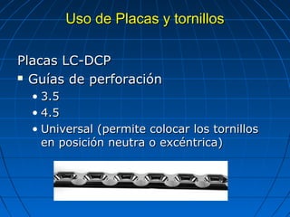 UUssoo ddee PPllaaccaass yy ttoorrnniillllooss 
PPllaaccaass LLCC-DDCCPP 
 GGuuííaass ddee ppeerrffoorraacciióónn 
• 33..5 
• 44..5 
• UUnniivveerrssaall ((ppeerrmmiittee ccoollooccaarr llooss ttoorrnniillllooss 
eenn ppoossiicciióónn nneeuuttrraa oo eexxccéénnttrriiccaa)) 
 