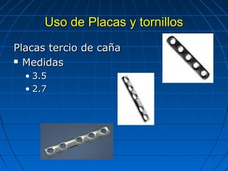 UUssoo ddee PPllaaccaass yy ttoorrnniillllooss 
PPllaaccaass tteerrcciioo ddee ccaaññaa 
 MMeeddiiddaass 
• 33..5 
• 22..77 
 