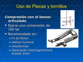 UUssoo ddee PPllaaccaass yy ttoorrnniillllooss 
CCoommpprreessiióónn ccoonn eell tteennssoorr 
aarrttiiccuullaaddoo 
 EEjjeerrccee uunnaa ccoommpprreessiióónn ddee 
110000 kkpp 
 RReeccoommeennddaaddoo eenn:: 
• FFxx ddee fféémmuurr 
• ddiiááffiissiiss hhuummeerraall 
• oosstteeoottoommííaass 
• SSeeppaarraacciióónn iinntteerrffrraaggmmeennttaarriiaa 
eexxcceeddee 22mmmm 
 