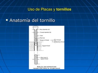 UUssoo ddee PPllaaccaass yy ttoorrnniillllooss 
 AAnnaattoommííaa ddeell ttoorrnniilllloo 
 