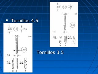 TToorrnniillllooss 44..55 
 TToorrnniillllooss 33..55 
 