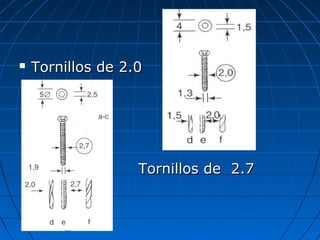  TToorrnniillllooss ddee 22..00 
 TToorrnniillllooss ddee 22..77 
 