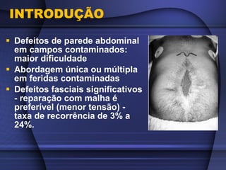 hérnias abdominais inguinais e umbilicais - Leonardo Ferraz