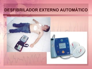 DESFIBRILADOR EXTERNO AUTOMÁTICO 