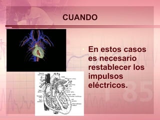CUANDO En estos casos es necesario restablecer los impulsos eléctricos. 