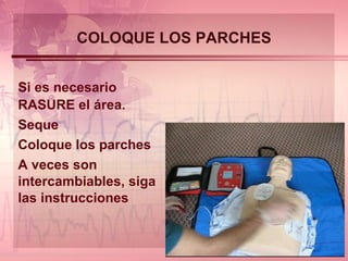 COLOQUE LOS PARCHES Si es necesario RASURE el área. Seque Coloque los parches A veces son intercambiables, siga las instrucciones 