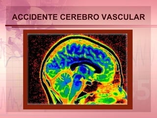 ACCIDENTE CEREBRO VASCULAR 