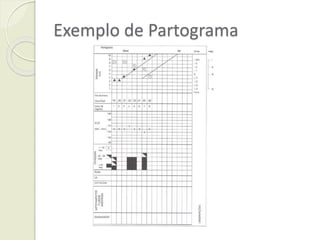 Exemplo de Partograma
 