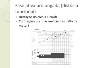 Fase ativa prolongada (distócia
funcional)
 Dilatação do colo < 1 cm/h
 Contrações uterinas ineficientes (falta de
motor)
 