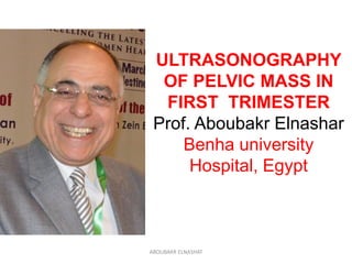 Ultrasonography of pelvic mass in early pregnancy | PDF