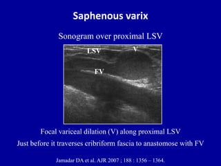 Ultrasound of the abdominal wall hernias | PPTX