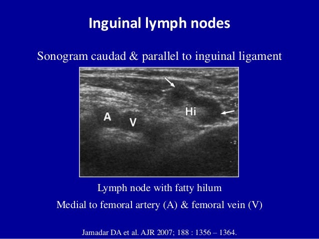 Ultrasound of the abdominal wall hernias