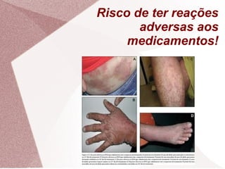 Risco de ter reações
adversas aos
medicamentos!
 