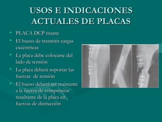 UUSSOOSS EE IINNDDIICCAACCIIOONNEESS 
AACCTTUUAALLEESS DDEE PPLLAACCAASS 
• PPLLAACCAA DDCCPP ttiirraannttee 
• EEll hhuueessoo ddee ttrraassmmiittiirr ccaarrggaass 
eexxccéénnttrriiccaass 
• LLaa ppllaaccaa ddeebbee ccoollooccaarrssee ddeell 
llaaddoo ddee tteennssiióónn 
• LLaa ppllaaccaa ddeebbeerráá ssooppoorrttaarr llaass 
ffuueerrzzaass ddee tteennssiióónn 
• EEll hhuueessoo ddeebbeerráá sseerr rreessiisstteennttee 
aa llaa ffuueerrzzaa ddee ccoommpprreessiióónn 
rreessuullttaannttee ddee llaa ppllaaccaa eenn 
ffuueerrzzaass ddee ddiissttrraacccciióónn 
 