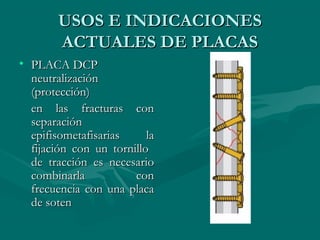 UUSSOOSS EE IINNDDIICCAACCIIOONNEESS 
AACCTTUUAALLEESS DDEE PPLLAACCAASS 
• PPLLAACCAA DDCCPP 
nneeuuttrraalliizzaacciióónn 
((pprrootteecccciióónn)) 
eenn llaass ffrraaccttuurraass ccoonn 
sseeppaarraacciióónn 
eeppiiffiissoommeettaaffiissaarriiaass llaa 
ffiijjaacciióónn ccoonn uunn ttoorrnniilllloo 
ddee ttrraacccciióónn eess nneecceessaarriioo 
ccoommbbiinnaarrllaa ccoonn 
ffrreeccuueenncciiaa ccoonn uunnaa ppllaaccaa 
ddee ssootteenn 
 