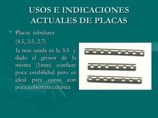 UUSSOOSS EE IINNDDIICCAACCIIOONNEESS 
AACCTTUUAALLEESS DDEE PPLLAACCAASS 
• PPllaaccaass ttuubbuullaarreess 
((44..55,, 33..55,, 22..77)) 
llaa mmaass uussaaddaa eess llaa 33..55 yy 
ddaaddoo eell ggrroossoorr ddee llaa 
mmiissmmaa ((11mmmm)) ccoonnffiieerree 
ppooccaa eessttaabbiilliiddaadd ppeerroo eess 
iiddeeaall ppaarraa zzoonnaass ccoonn 
ppooccaa ccoobbeerrttuurraa ccuuttáánneeaa 
 