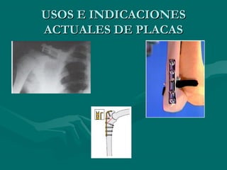 UUSSOOSS EE IINNDDIICCAACCIIOONNEESS 
AACCTTUUAALLEESS DDEE PPLLAACCAASS 
 