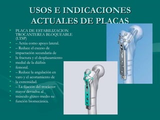 UUSSOOSS EE IINNDDIICCAACCIIOONNEESS 
AACCTTUUAALLEESS DDEE PPLLAACCAASS 
• PLACA DE ESTABILIZACION 
TROCANTEREA BLOQUEABLE 
(LTSP) 
• – Actúa como apoyo lateral. 
• – Reduce el exceso de 
• impactación secundaria de 
• la fractura y el desplazamiento 
• medial de la diáfisis 
• femoral. 
• – Reduce la angulación en 
• varo y el acortamiento de 
• la extremidad. 
• – La fijación del trocánter 
• mayor devuelve al 
• músculo glúteo medio su 
• función biomecánica. 
 