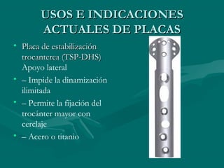 UUSSOOSS EE IINNDDIICCAACCIIOONNEESS 
AACCTTUUAALLEESS DDEE PPLLAACCAASS 
• PPllaaccaa ddee eessttaabbiilliizzaacciióónn 
ttrrooccaanntteerreeaa ((TTSSPP--DDHHSS)) 
Apoyo lateral 
• – Impide la dinamización 
ilimitada 
• – Permite la fijación del 
trocánter mayor con 
cerclaje 
• – Acero o titanio 
 