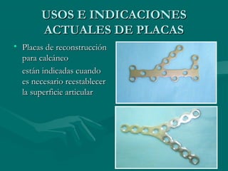 UUSSOOSS EE IINNDDIICCAACCIIOONNEESS 
AACCTTUUAALLEESS DDEE PPLLAACCAASS 
• PPllaaccaass ddee rreeccoonnssttrruucccciióónn 
ppaarraa ccaallccáánneeoo 
eessttáánn iinnddiiccaaddaass ccuuaannddoo 
eess nneecceessaarriioo rreeeessttaabblleecceerr 
llaa ssuuppeerrffiicciiee aarrttiiccuullaarr 
 