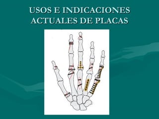 UUSSOOSS EE IINNDDIICCAACCIIOONNEESS 
AACCTTUUAALLEESS DDEE PPLLAACCAASS 
 