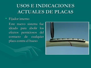 UUSSOOSS EE IINNDDIICCAACCIIOONNEESS 
AACCTTUUAALLEESS DDEE PPLLAACCAASS 
• FFiijjaaddoorr iinntteerrnnoo 
EEssttee nnuueevvoo ssiisstteemmaa ffuuee 
iiddeeaaddoo ppaarraa aabboolliirr llooss 
eeffeeccttooss ppeerrnniicciioossooss ddeell 
ccoonnttaaccttoo ddee ccuuaallqquuiieerr 
ppllaaccaa ccoonnttrraa eell hhuueessoo 
 