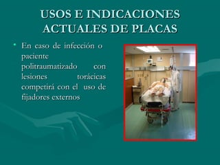 UUSSOOSS EE IINNDDIICCAACCIIOONNEESS 
AACCTTUUAALLEESS DDEE PPLLAACCAASS 
• EEnn ccaassoo ddee iinnffeecccciióónn oo 
ppaacciieennttee 
ppoolliittrraauummaattiizzaaddoo ccoonn 
lleessiioonneess ttoorráácciiccaass 
ccoommppeettiirráá ccoonn eell uussoo ddee 
ffiijjaaddoorreess eexxtteerrnnooss 
 