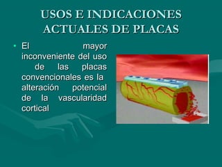 UUSSOOSS EE IINNDDIICCAACCIIOONNEESS 
AACCTTUUAALLEESS DDEE PPLLAACCAASS 
• EEll mmaayyoorr 
iinnccoonnvveenniieennttee ddeell uussoo 
ddee llaass ppllaaccaass 
ccoonnvveenncciioonnaalleess eess llaa 
aalltteerraacciióónn ppootteenncciiaall 
ddee llaa vvaassccuullaarriiddaadd 
ccoorrttiiccaall 
 