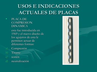 UUSSOOSS EE IINNDDIICCAACCIIOONNEESS 
AACCTTUUAALLEESS DDEE PPLLAACCAASS 
• PPLLAACCAA DDEE 
CCOOMMPPRREESSIIOONN 
DDIINNAAMMIICCAA 
eessttaa ffuuee iinnttrroodduucciiddaa eenn 
11996699 yy eell nnuueevvoo ddiisseeññoo ddee 
llooss aagguujjeerrooss ddee eessttaa llee 
ppeerrmmiitteenn aaccttuuaarr ddee 
ddiiffeerreenntteess ffoorrmmaass:: 
aa)) CCoommpprreessiióónn 
bb)) TTiirraannttee 
cc)) ssoossttéénn 
dd)) nneeuuttrraalliizzaacciióónn 
 