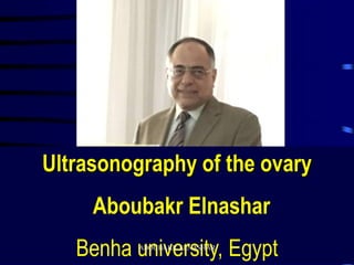 Ultrasonography of the ovary
Aboubakr Elnashar
Benha university, EgyptABOUBAKR ELNASHAR
 