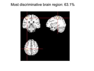 Most discriminative brain region: 63.1%
 