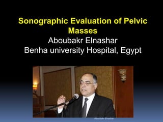 Sonographic Evaluation of Pelvic
Masses
Aboubakr Elnashar
Benha university Hospital, Egypt
Aboubakr Elnashar
 