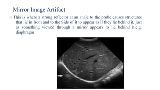Mirror Image Artifact
• This is where a strong reflector at an anale to the probe causes structures
that lie in front and to the Side of it to appear as if they lie behind it, just
as something viewed through a mirror appears to lie behind it.e.g.
diaphragm
 