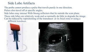 Side Lobe Artifacts
The probe cannot produce a pulse that travels purely in one direction.
Pulses also travel off at specific angles,
Side lobes may interact With Strong reflectors that lie outside the scan plane.
These side lobes are relatively weak and so normally do little to degrade the image.
Can be reduced by repositioning of the transducer .or its focal zone or using a
different transducer.
 