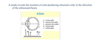 A-mode reveals the location of echo-producing structures only in the direction
of the ultrasound beam.
 