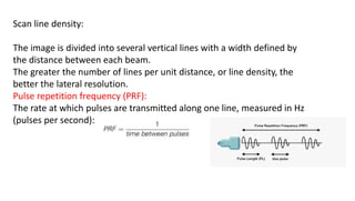 Scan line density:
The image is divided into several vertical lines with a width defined by
the distance between each beam.
The greater the number of lines per unit distance, or line density, the
better the lateral resolution.
Pulse repetition frequency (PRF):
The rate at which pulses are transmitted along one line, measured in Hz
(pulses per second):
 