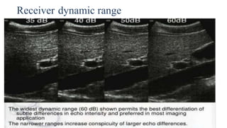 Receiver dynamic range
 
