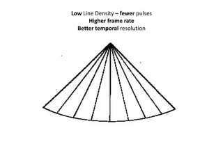 Low Line Density – fewer pulses
Higher frame rate
Better temporal resolution
 