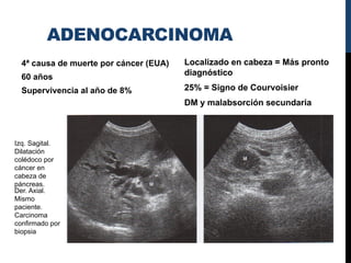 US PÁNCREAS Descripcion, anatomia parologiapptx | PPTX